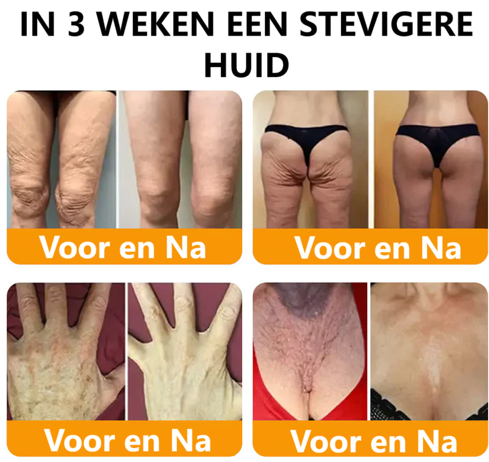BeeLixir- Jeugdcrème