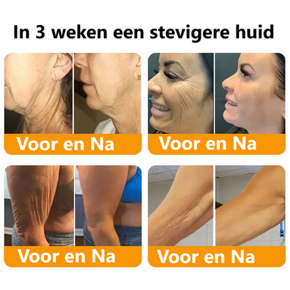 BeeLixir- Jeugdcrème