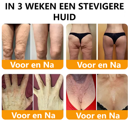 BeeLixir- Jeugdcrème