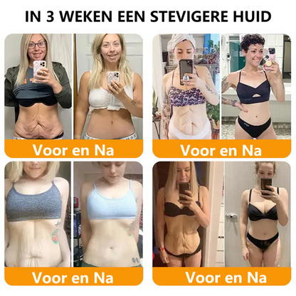 BeeLixir- Jeugdcrème