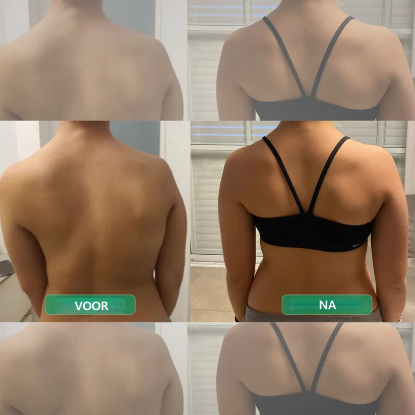 RugRecht™ – Zeg Dag Tegen Rug- & Nekpijn